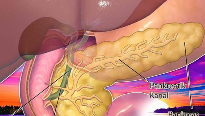 Pankreas Kanserinin Belirtileri ve Tedavisi: Yeni Nesil Tedaviler